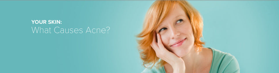 What Causes Acne?