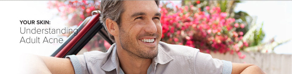 Treatment for Adult Acne