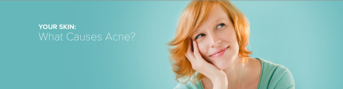 What Causes Acne?
