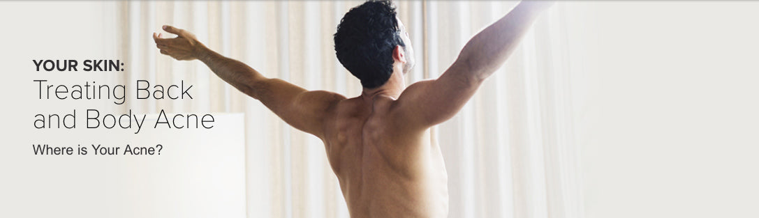 Back & Body Acne Causes